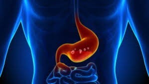 MİDE ASİDİNİZ YETERLİ Mİ? YA DEĞİLSE?